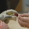 Following the breakthroughs in prosthetics | 60 Minutes